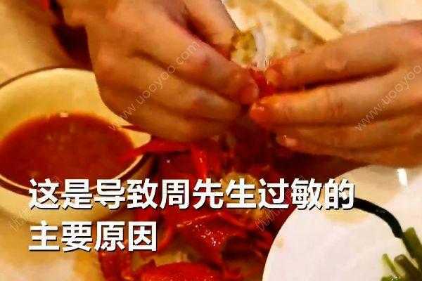 土壤过敏症状（小龙虾过敏症状）-图3