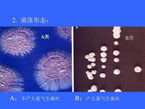 土壤放线菌（土壤放线菌菌落计数）-图1